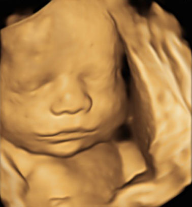 Little Gram 3D Image