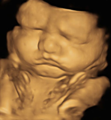 Little Gram 3D Image