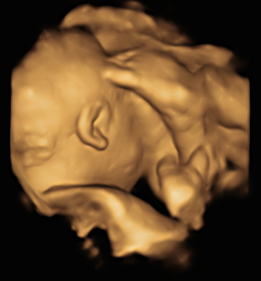 Little Gram 3D Image