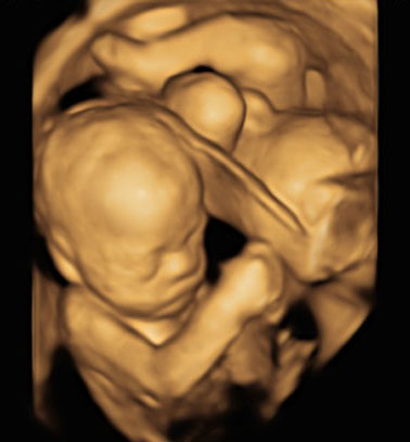 Little Gram 3D Image