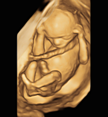 Little Gram 3D Image