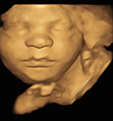 Little Gram 3D Image