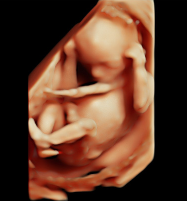 Little Gram HD Live or 5D Image