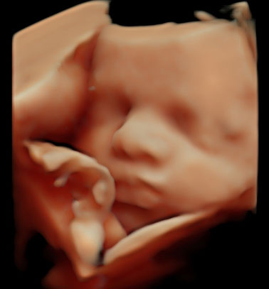 Little Gram HD Live or 5D Image