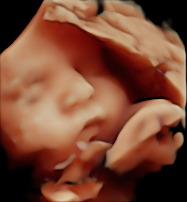 Little Gram HD Live or 5D Image