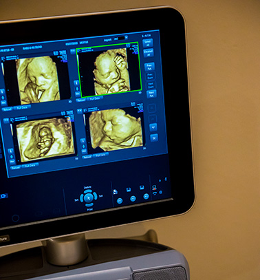 Little Gram 4D Scanning Studio