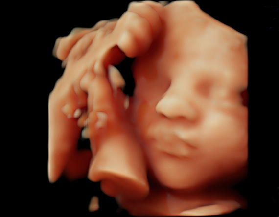 3D/4D/5D/HD Live Combination Bonding Scan