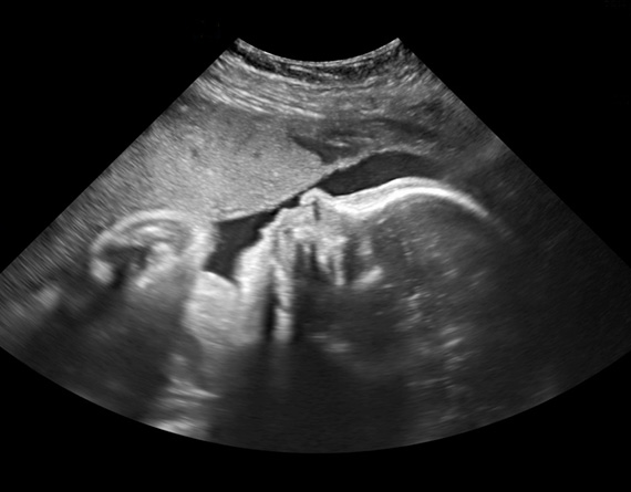 2D Scan