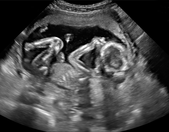 2D Gender Scan