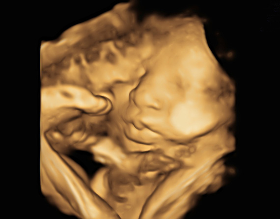 3D/4D Bonding Scan